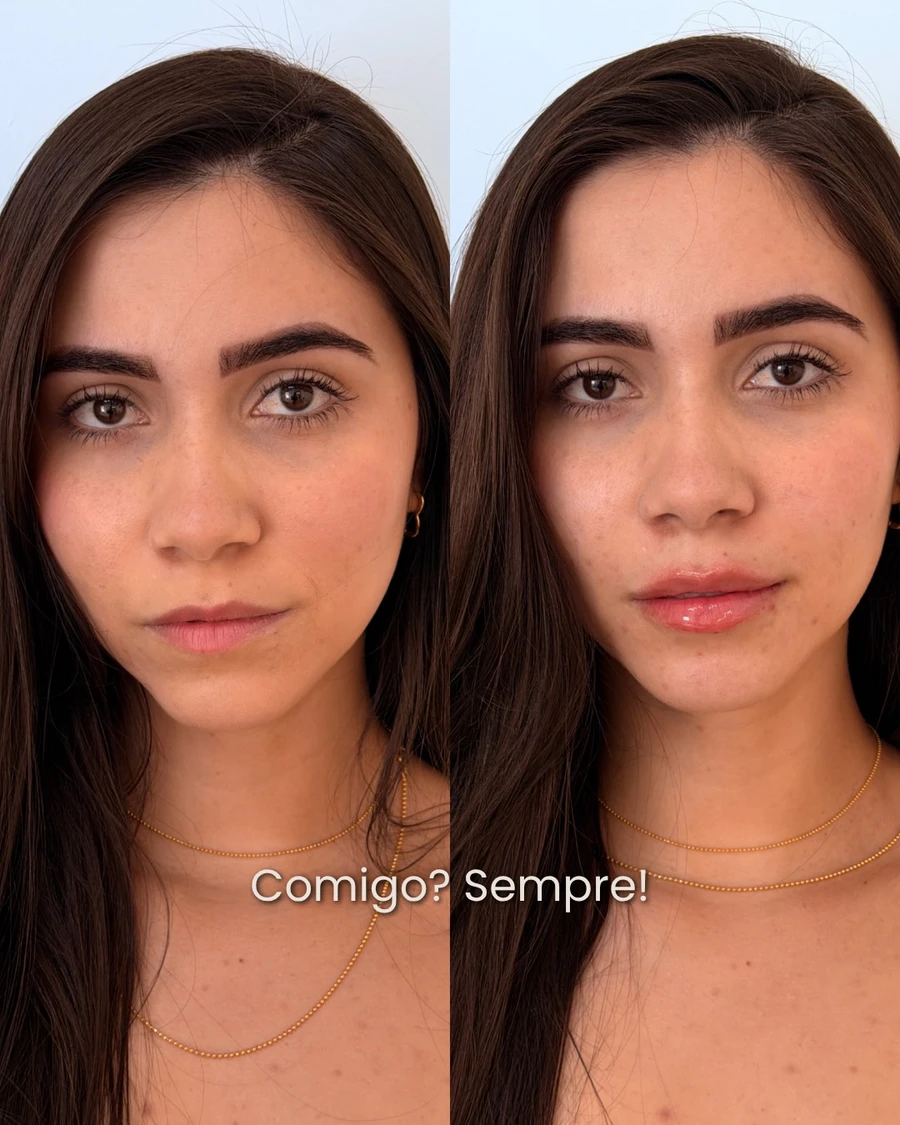 Montagem frontal de antes e depois, registro 03